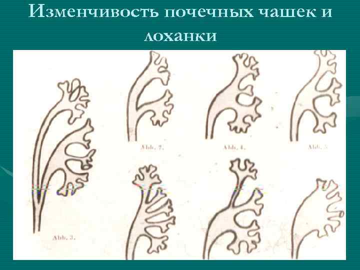 Изменчивость почечных чашек и лоханки 