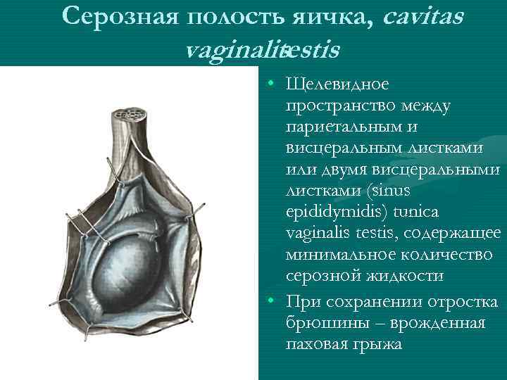 Серозная полость яичка, cavitas vaginalis testis • Щелевидное пространство между париетальным и висцеральным листками