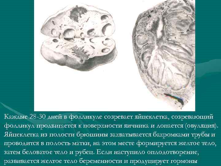 Каждые 28 -30 дней в фолликуле созревает яйцеклетка, созревающий фолликул продвигается к поверхности яичника