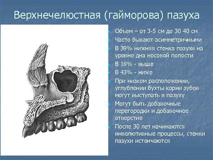 Правая верхнечелюстная пазуха где находится картинка