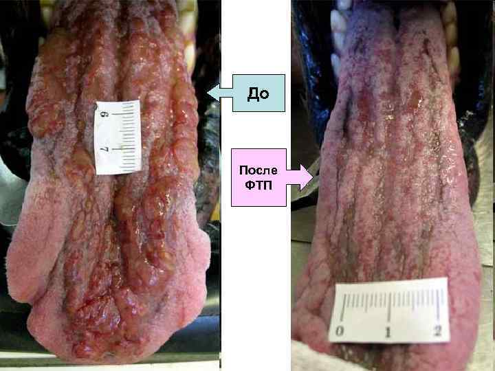 До После ФТП 