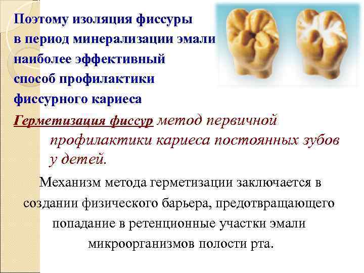 Поэтому изоляция фиссуры в период минерализации эмали наиболее эффективный способ профилактики фиссурного кариеса Герметизация