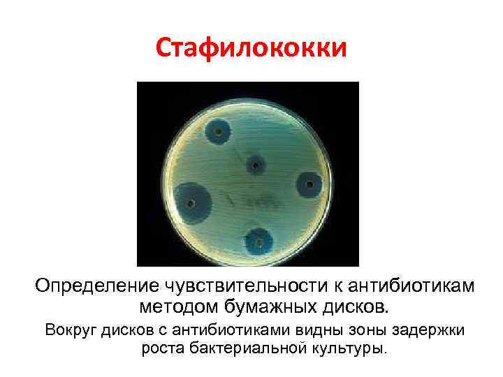 Определение чувствительности к антибиотикам