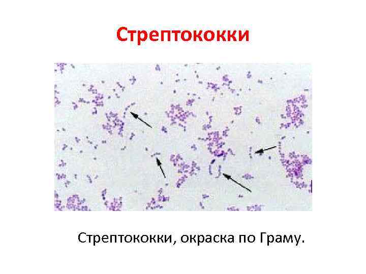 Стрептококки, окраска по Граму. Стрептококки, окраска по Граму.