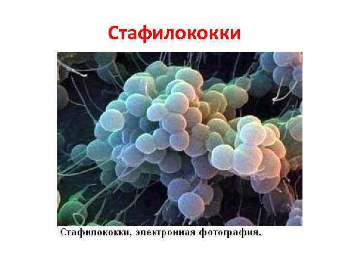 Стафилококки Стафилококки