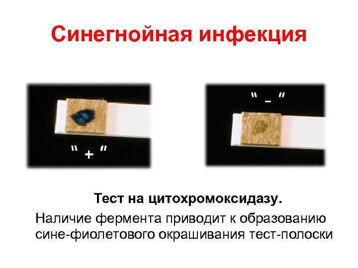 Синегнойная инфекция Тест на цитохромоксидазу. Наличие фермента приводит к образованию сине-фиолетового Синегнойная инфекция Тест на цитохромоксидазу. Наличие фермента приводит к образованию сине-фиолетового