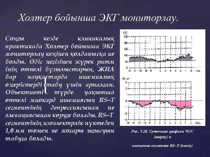 Холтер бойынша ЭКГ мониторлау. Соңғы кезде клиникалық практикада Холтер бойынша ЭКГ мониторлау кеңінен қолданысқа