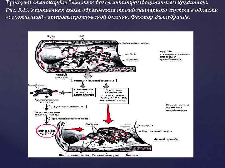 Тұрақсыз стенокардия дамитын болса антитромбоциттік ем қолданады. Рис. 5. 43. Упрощенная схема образования тромбоцитарного
