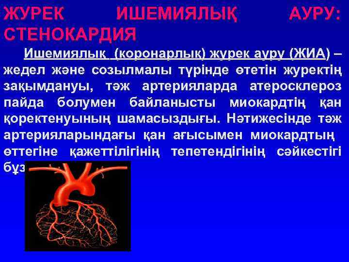 ЖУРЕК ИШЕМИЯЛЫҚ СТЕНОКАРДИЯ АУРУ: Ишемиялық (коронарлық) журек ауру (ЖИА) – жедел және созылмалы түрінде