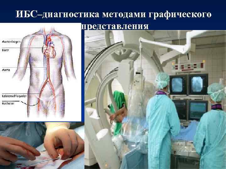 ИБС–диагностика методами графического представления 