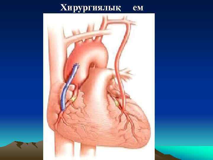Хирургиялық ем 
