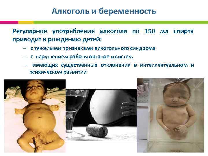 Алкоголь и беременность Регулярное употребление алкоголя по 150 мл спирта приводит к рождению детей: