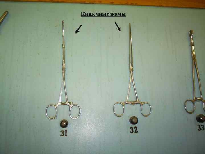 Кишечные жомы 