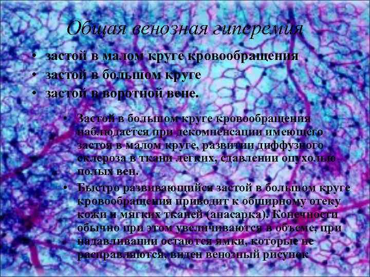 Общая венозная гиперемия • застой в малом круге кровообращения • застой в большом круге