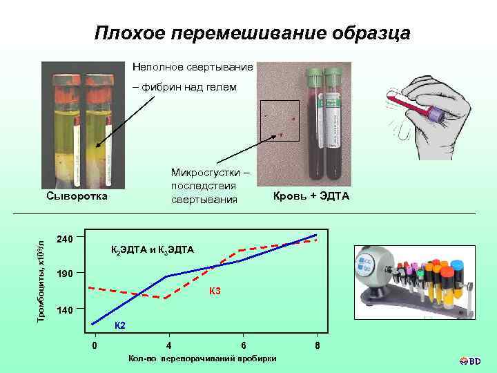 Плохое перемешивание образца Неполное свертывание – фибрин над гелем Микросгустки – последствия свертывания Тромбоциты,