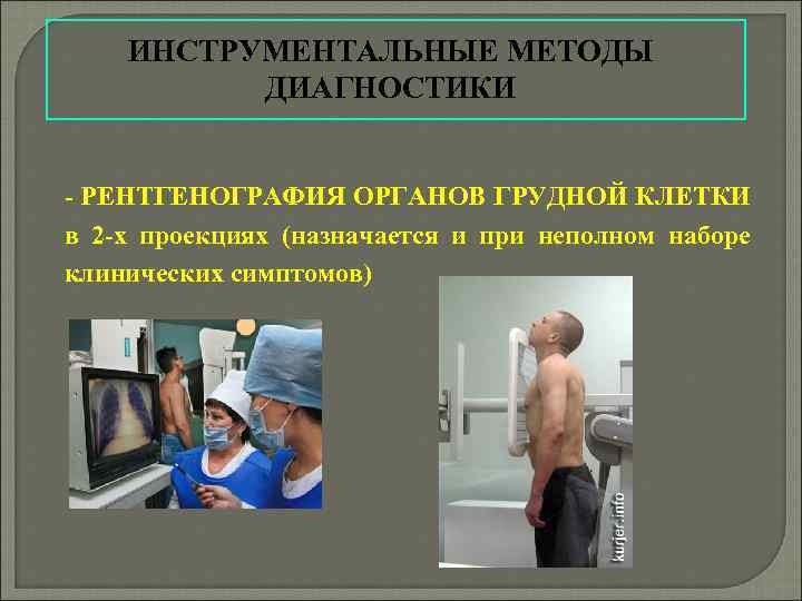  ИНСТРУМЕНТАЛЬНЫЕ МЕТОДЫ ДИАГНОСТИКИ - РЕНТГЕНОГРАФИЯ ОРГАНОВ ГРУДНОЙ КЛЕТКИ в 2 -х проекциях (назначается