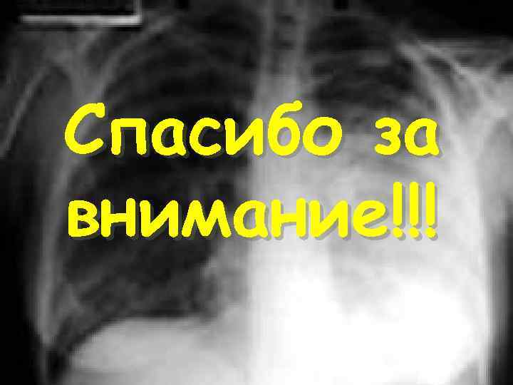 Спасибо за внимание!!! 