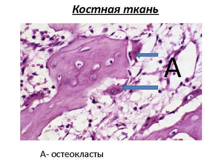 Костная ткань А А- остеокласты 