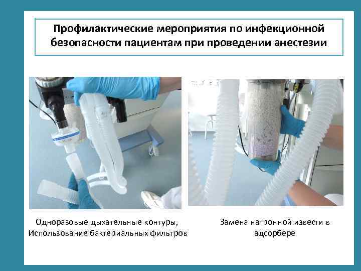 Профилактические мероприятия по инфекционной безопасности пациентам при проведении анестезии Одноразовые дыхательные контуры, Использование бактериальных