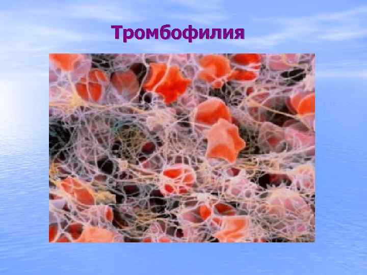 Тромбофилия 