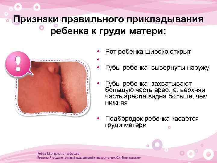 Признаки правильного прикладывания ребенка к груди матери: • Рот ребенка широко открыт • •