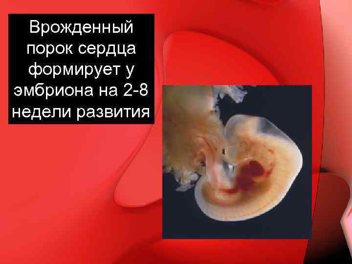 Врожденный порок сердца формирует у эмбриона на 2 -8 недели развития 
