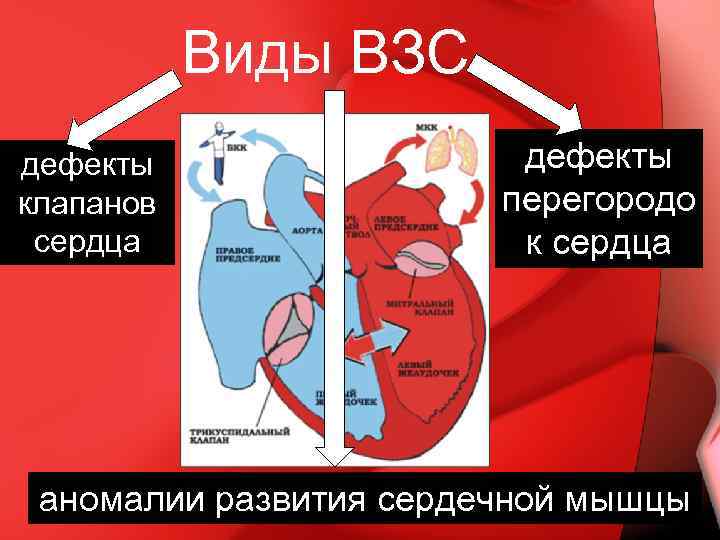 Виды ВЗС дефекты клапанов сердца дефекты перегородо к сердца аномалии развития сердечной мышцы 