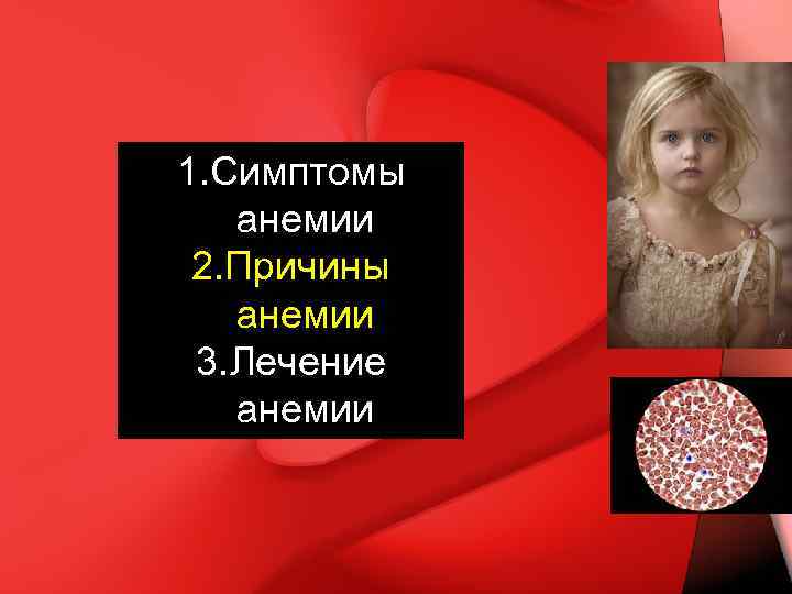 1. Симптомы анемии 2. Причины анемии 3. Лечение анемии 