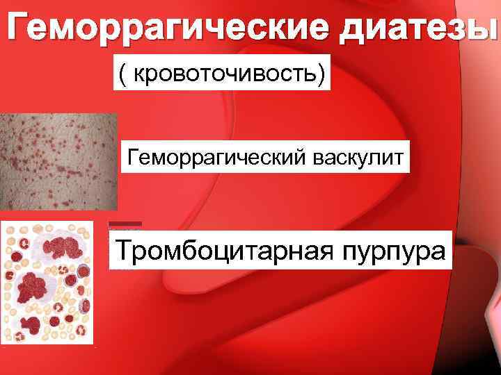 Геморрагические диатезы ( кровоточивость) Геморрагический васкулит Тромбоцитарная пурпура 