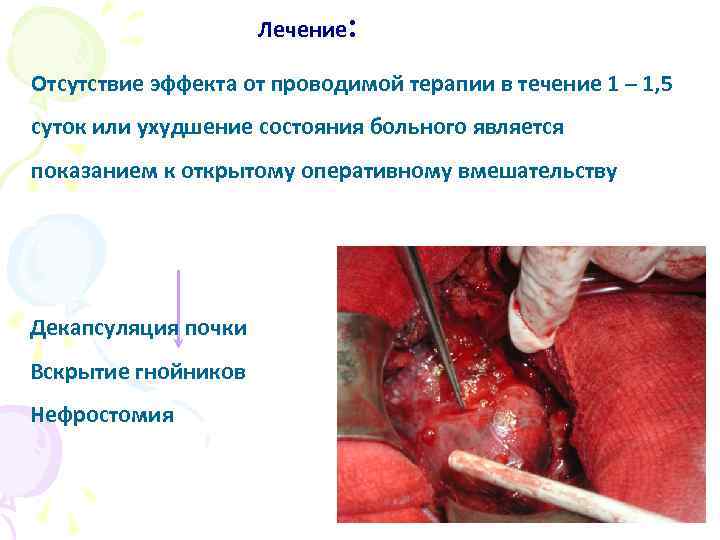 Лечение: Отсутствие эффекта от проводимой терапии в течение 1 – 1, 5 суток или