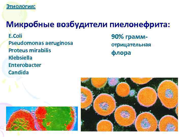 Этиология: Микробные возбудители пиелонефрита: E. Coli Pseudomonas aeruginosa Proteus mirabilis Кlebsiella Enterobacter Candida 90%