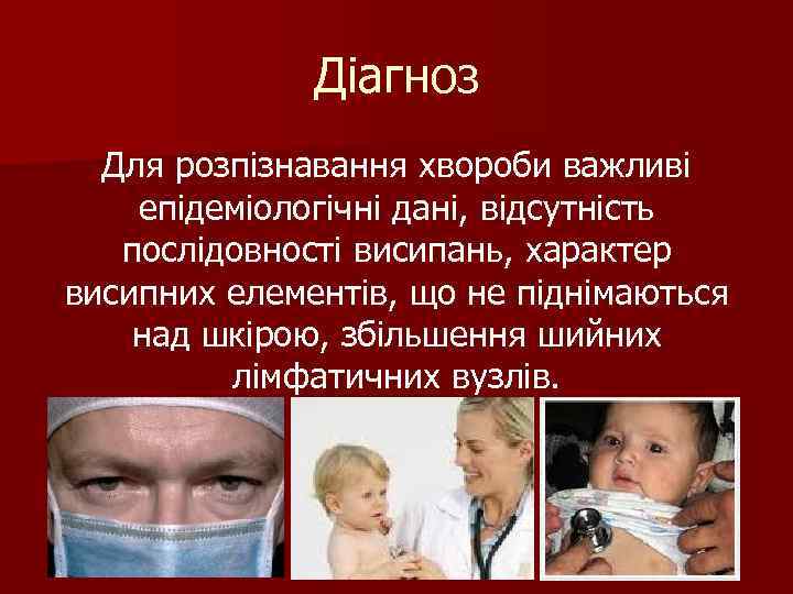 Діагноз Для розпізнавання хвороби важливі епідеміологічні дані, відсутність послідовності висипань, характер висипних елементів, що