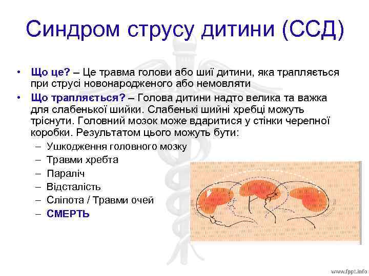 Синдром струсу дитини (ССД) • Що це? – Це травма голови або шиї дитини,