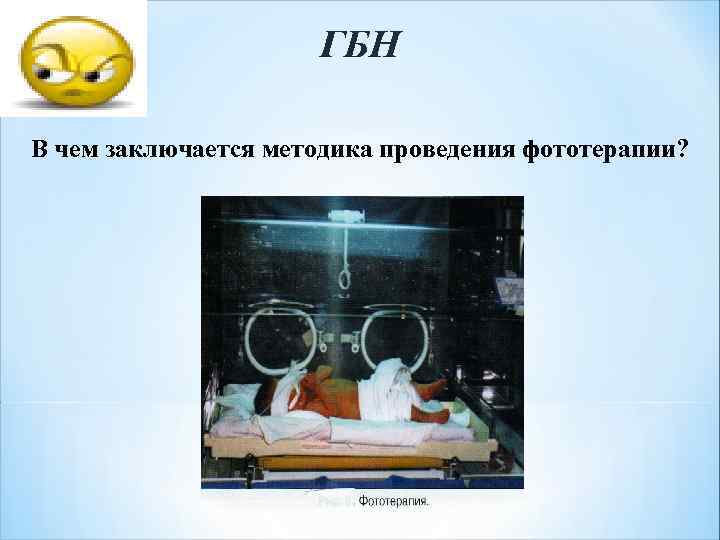 ГБН В чем заключается методика проведения фототерапии? 