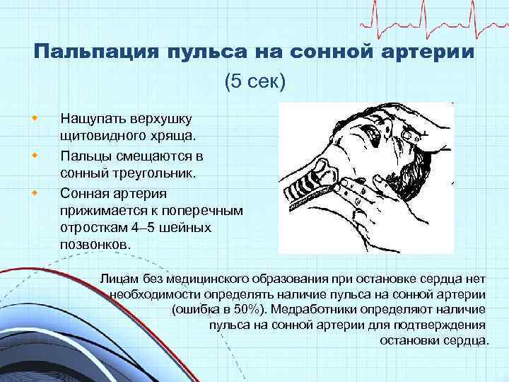 Сонная артерия потеря сознания