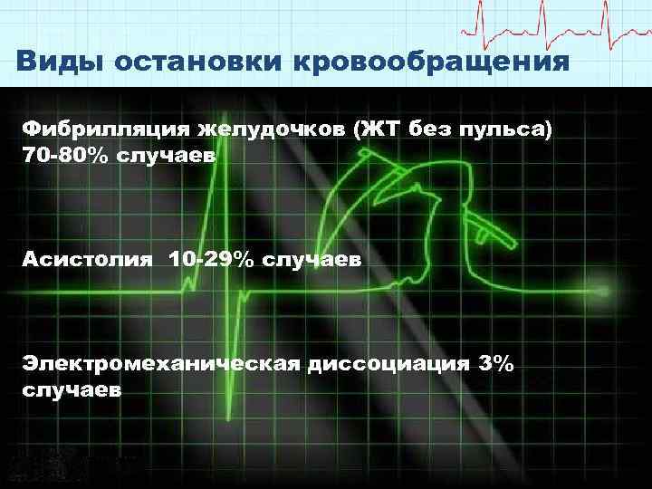 Виды остановки кровообращения Фибрилляция желудочков (ЖТ без пульса) 70 -80% случаев Асистолия 10 -29%