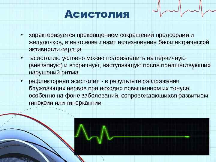 Асистолия • характеризуется прекращением сокращений предсердий и желудочков, в ее основе лежит исчезновение биоэлектрической
