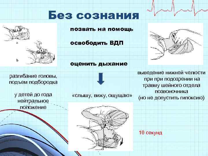 Без сознания позвать на помощь освободить ВДП оценить дыхание разгибание головы, подъем подбородка у