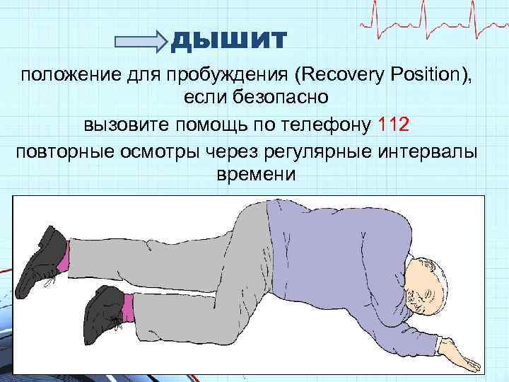дышит положение для пробуждения (Recovery Position), если безопасно вызовите помощь по телефону 112 повторные