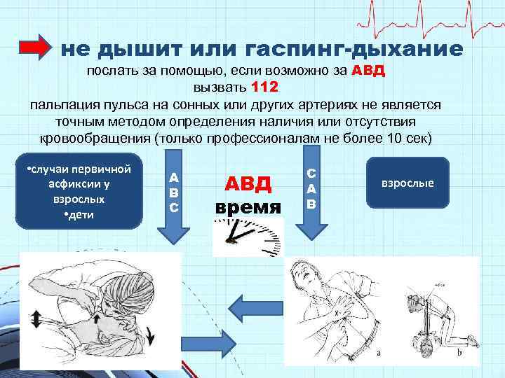 не дышит или гаспинг-дыхание послать за помощью, если возможно за АВД вызвать 112 пальпация