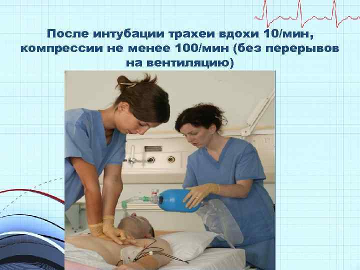 После интубации трахеи вдохи 10/мин, компрессии не менее 100/мин (без перерывов на вентиляцию) 