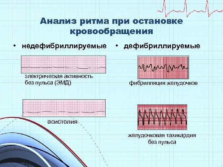 Анализ ритма при остановке кровообращения • недефибриллируемые электрическая активность без пульса (ЭМД) • дефибриллируемые