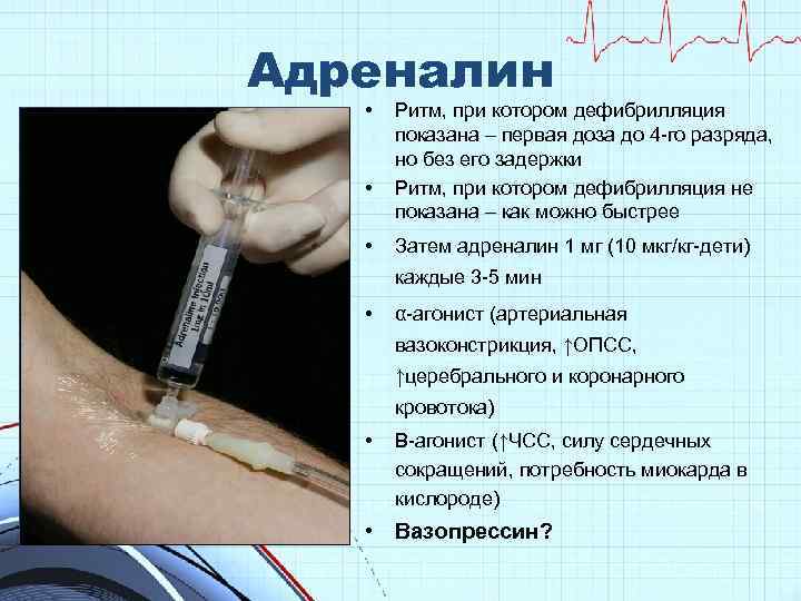 Адреналин • • • Ритм, при котором дефибрилляция показана – первая доза до 4