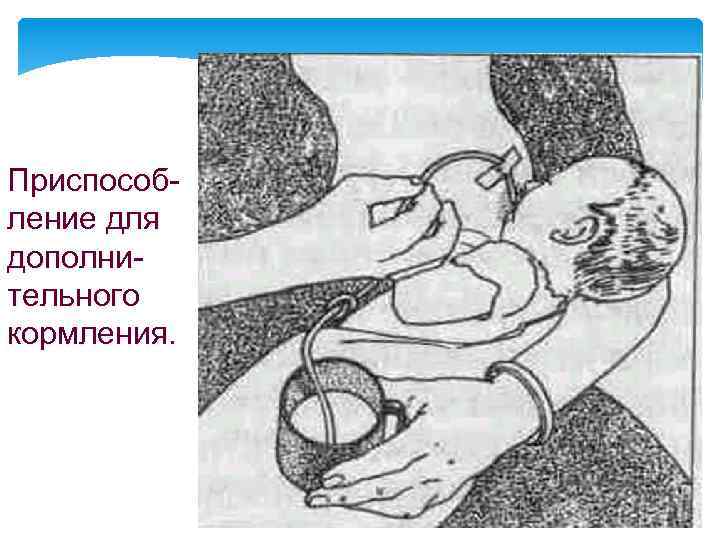 Приспособление для дополнительного кормления. 