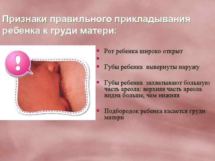 Признаки правильного прикладывания ребенка к груди матери: § Рот ребенка широко открыт § §