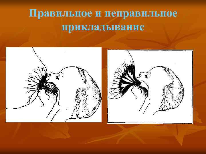Правильное и неправильное прикладывание 