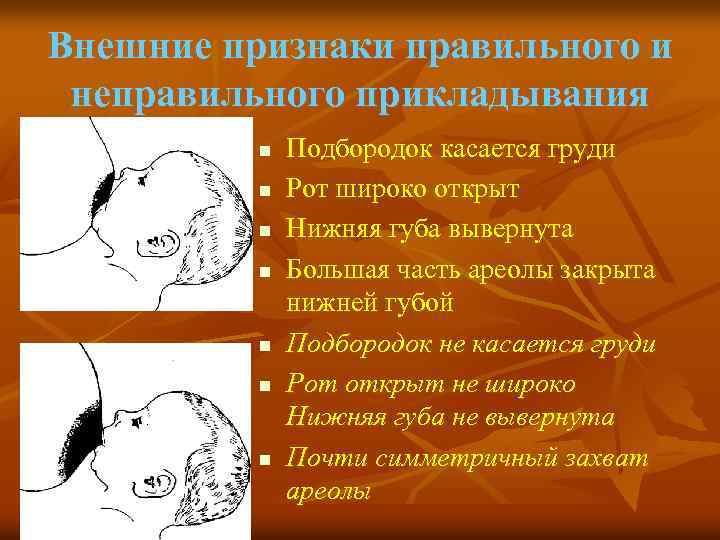Внешние признаки правильного и неправильного прикладывания n n n n Подбородок касается груди Рот