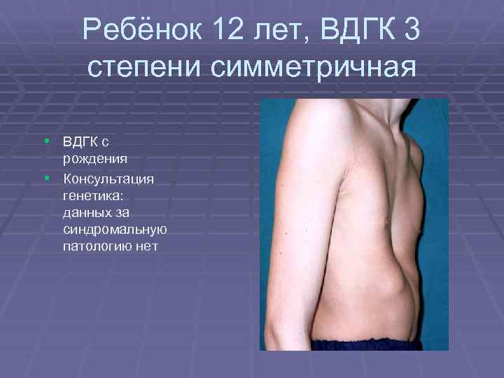 Ребёнок 12 лет, ВДГК 3 степени симметричная • ВДГК с рождения • Консультация генетика: