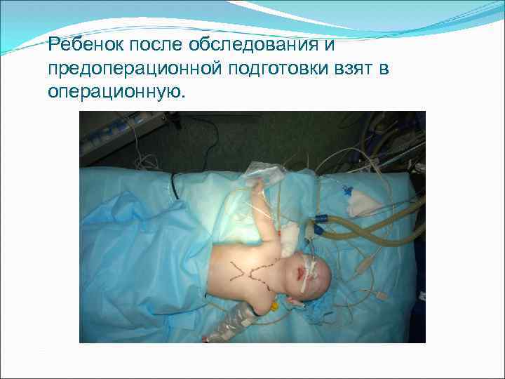 Ребенок после обследования и предоперационной подготовки взят в операционную. 
