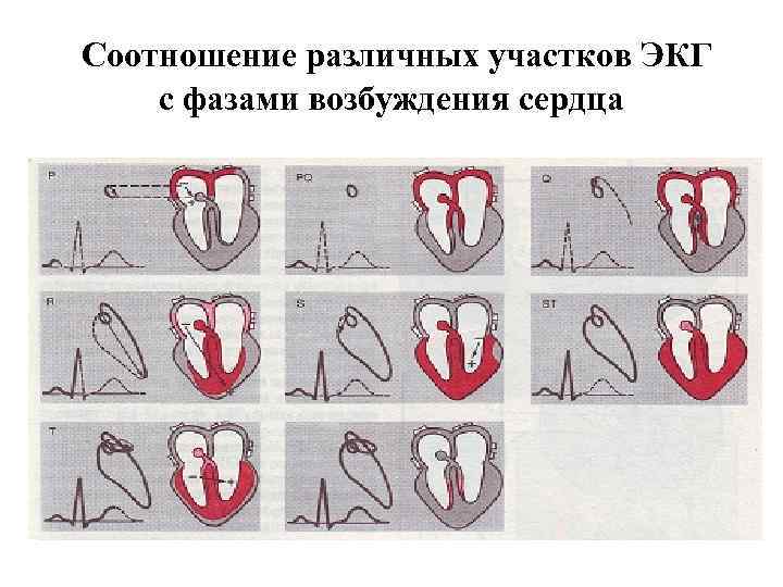 Соотношение различных участков ЭКГ с фазами возбуждения сердца 